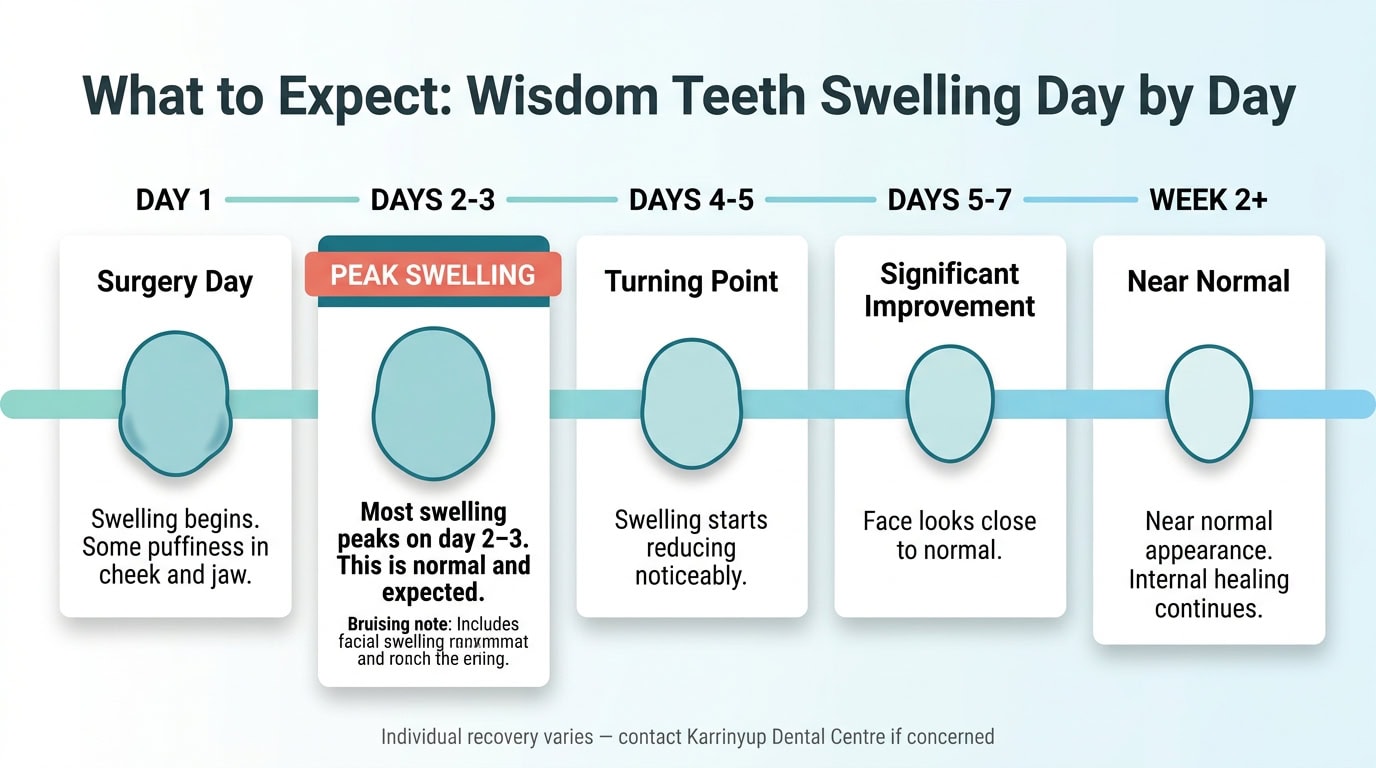 Day-by-day swelling timeline after wisdom teeth removal — what to expect each day